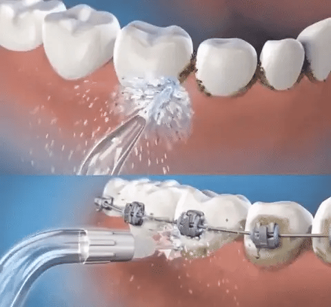 AquaSmile Irrigador bucal limpieza profunda portatil