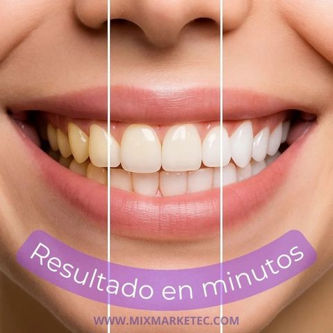 Hismile™ Blanqueador Dental V34, Sonrisa más blanca en minutos