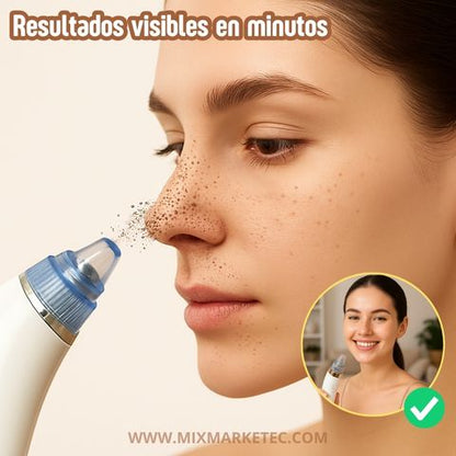 PureSkin® Extractor de Puntos Negros Eléctrico