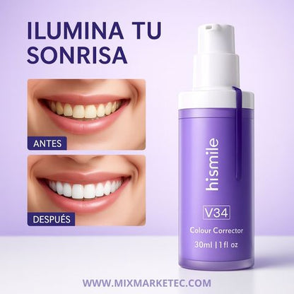Hismile™ Blanqueador Dental V34, Sonrisa más blanca en minutos