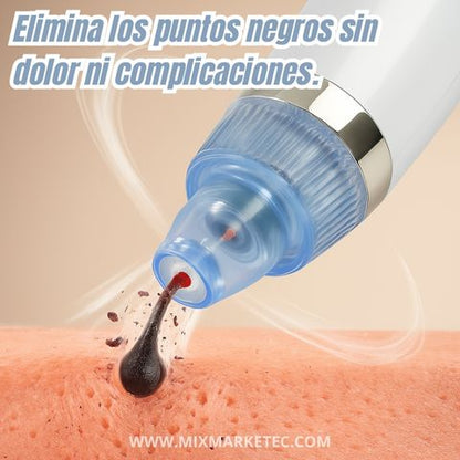 PureSkin® Extractor de Puntos Negros Eléctrico