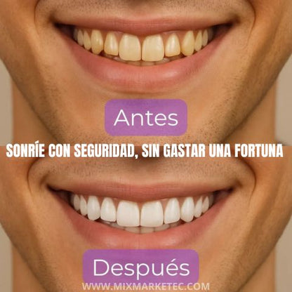Hismile™ Blanqueador Dental V34, Sonrisa más blanca en minutos