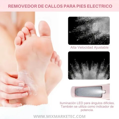 Smoothie™ Removedor De Callos Electrico, Elimina los callos sin dolor